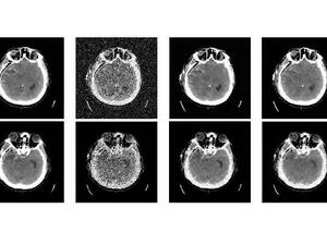 denoising1